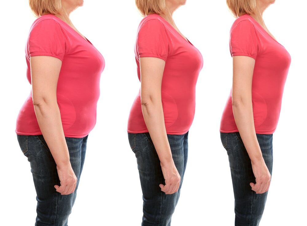 Will Losing Weight Help Sciatica?